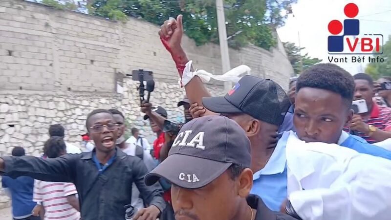 Haïti : Un étudiant en médecine blessé par balle lors d&rsquo;une manifestation pour la réouverture de l&rsquo;Hôpital général